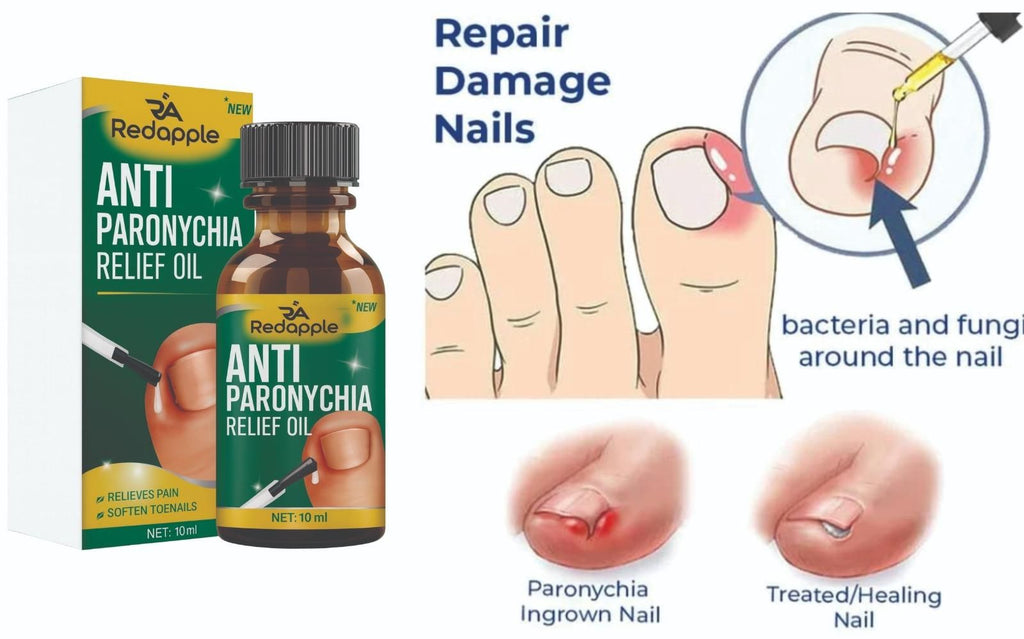 Anti Paronychia Relief Oil 20 ml Pack of 2